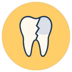 Crack Amalgam Filling